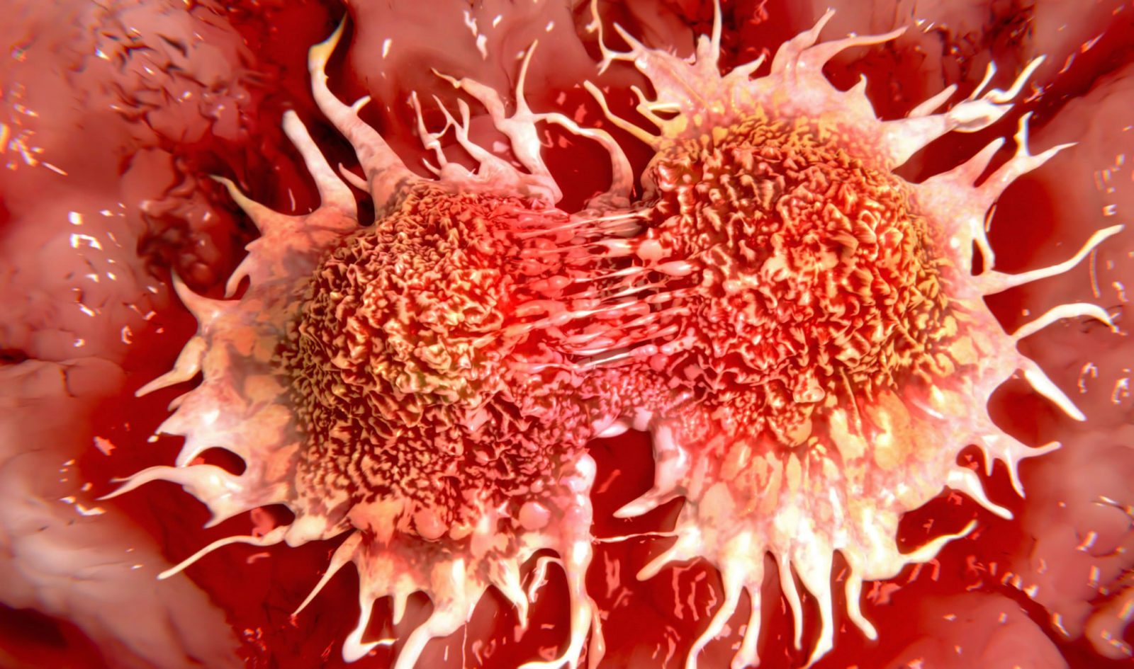 Calgary scrapbookers increase cash to combat blood cancers