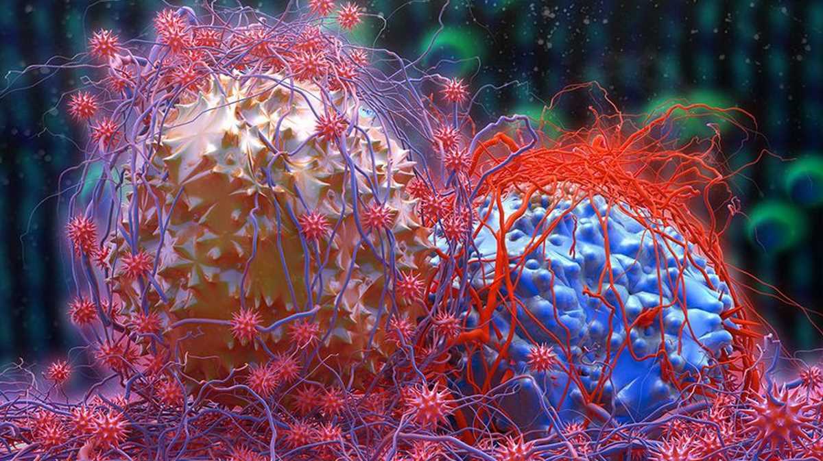 Blood most cancers 'was a robot' so he can go to school 1