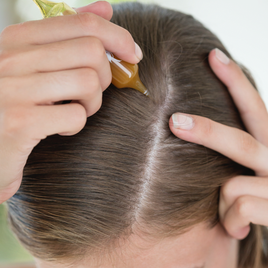 MIRACLE domestic treatments will assist you to save your hair loss