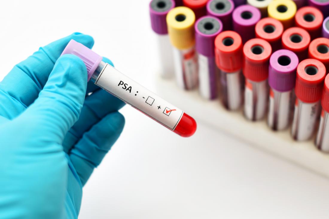 The link among better BPE levels and breast most cancers varies via risk