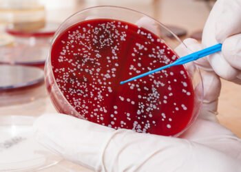 Scientists Identify New Types of a Blood Cancer and Potential Targeted Treatments