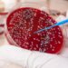 Scientists Identify New Types of a Blood Cancer and Potential Targeted Treatments