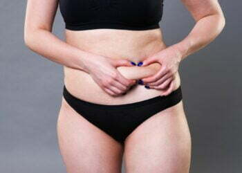 Free Tutorial on Reverse Tummy Tuck Procedures