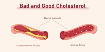 Get the Scoop on Good Cholesterol vs. Bad Cholesterol!