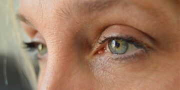 Cholesterol Eyes That Are Truly Dangerous