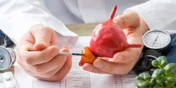 Urine Test Might Dictate Prostate Cancer Treatment