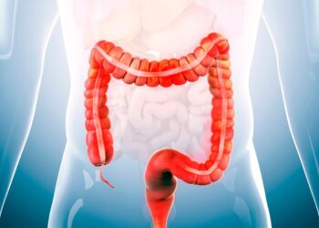 Irritable Bowel Syndrome