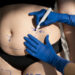 Why Consider Liposuction?